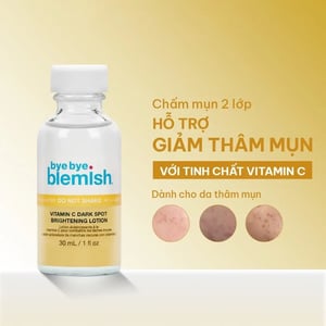 Chấm thâm mụn Bye Bye Blemish Vitamin C Dark Spot Brightening Lotion