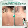 Sữa tắm giảm mụn Some By Mi giảm mụn lưng