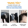 Nguyên nhân rụng tóc