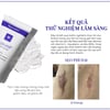 Kết quả thử nghiệm Gel xóa sẹo Rejuvaskin Rejuvasil Silicone Scar Gel