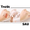 Trước và sau khi sử dụng Sữa rửa mặt d'Alba Deep Clean Foam Cleanser 80ml