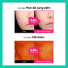 Hiệu quả sử dụng Beplain Cicaterol Blemish Pad
