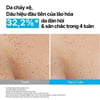 Trước và sau khi sử dụng Serum căng bóng da INNISFREE Retinol Green Tea PDRN Skinbooter Ampoule 25ml
