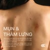 Xịt giảm mụn lưng Neo Acnes tác động 3in1 giảm mụn và thâm lưng