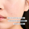 Bioderma Sebium Pore Refiner dành cho da