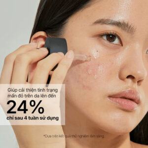 Cosrx The Niacinamide 15 cải thiện thâm đỏ trên da