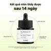 Cosrx The Retinol 0.5 Oil kết quả sau 14 ngày