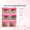 Hiệu quả sử dụng Gel dưỡng mắt Bioderma Sensibio Eye
