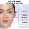 Hiệu quả sử dụng Tinh chất OLAY SUPER SERUM