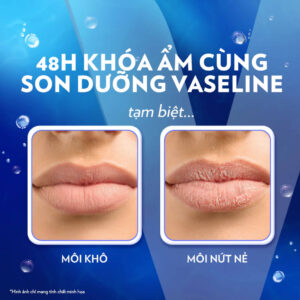 Son dưỡng Môi Mềm Mịn khóa ẩm 48h Vaseline Lip Therapy Original