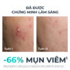 Tinh chất giảm mụn Eucerin DermoPure Clinical Triple Action