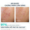 trước và sau khi sử dụng Eucerin DermoPure Clinical Peeling 10