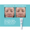 Trước và sau khi sử dụng Obagi Retinol 1.0
