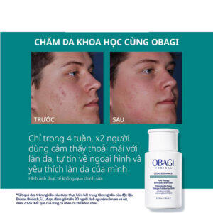 Trước và sau khi sử dụng Obagi Clenziderm M.D. Exfoliating