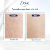 sữa tắm dưỡng thể Dove chăm da mềm mịn tức thì với dưỡng chất lợi khuẩn da